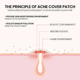 edistore, edistore.us, 200pcs/set Invisible Acne Pimple Patch Professional Face Skin Care 