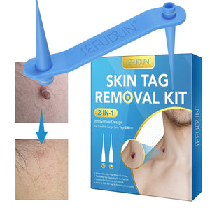 edistore, edistore.usSkin Tag Removal Kit Home Mole Wart Puntos Negros Remover 