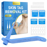 edistore, edistore.us Skin Tag Removal Kit Home Mole Wart Puntos Negros Remover 